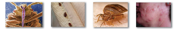 bed-bug-infestation bed bug infestation